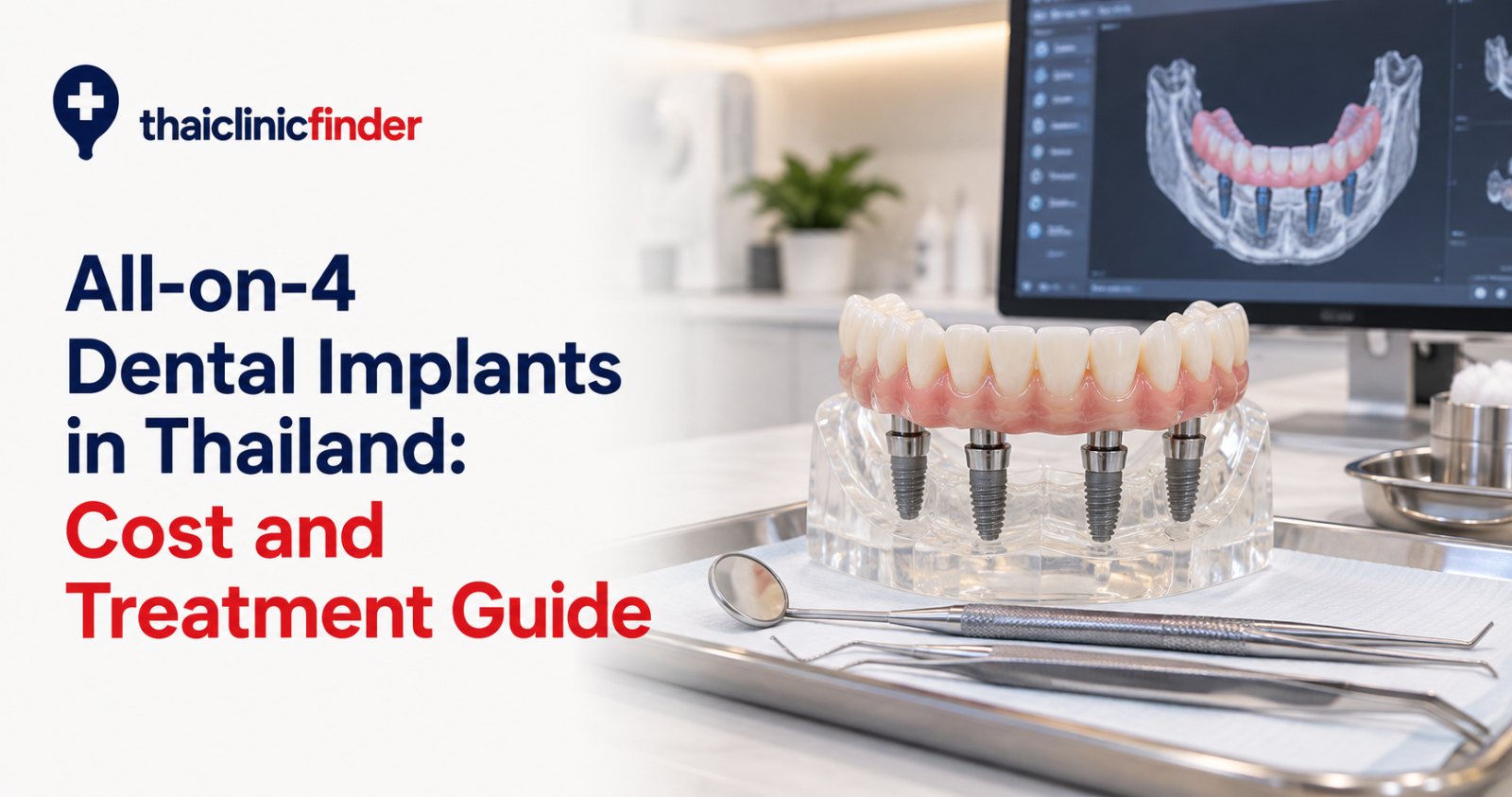 All-on-4 Dental Implants in Thailand: Cost, Treatment and What to Expect